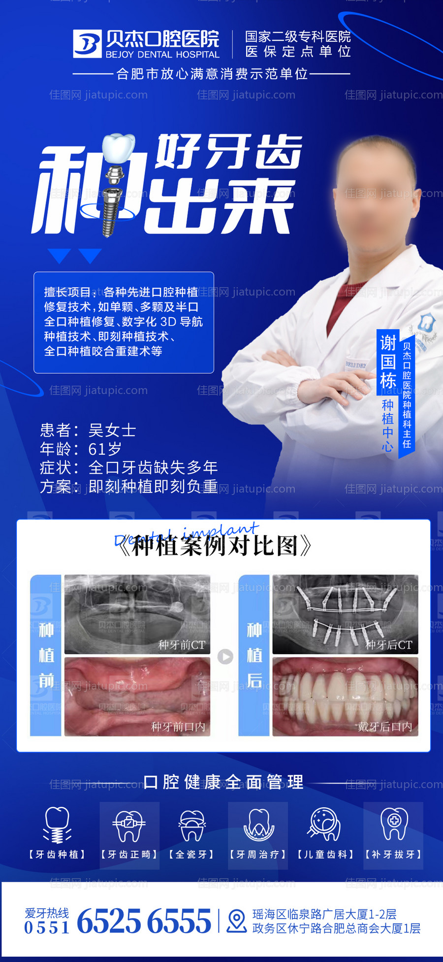 好牙种出来-谢医生种植案例图-源文件